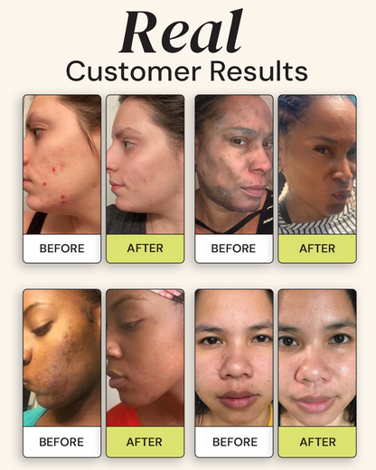 Gleamin 10-Minute Vitamin C Clay Mask 75ml